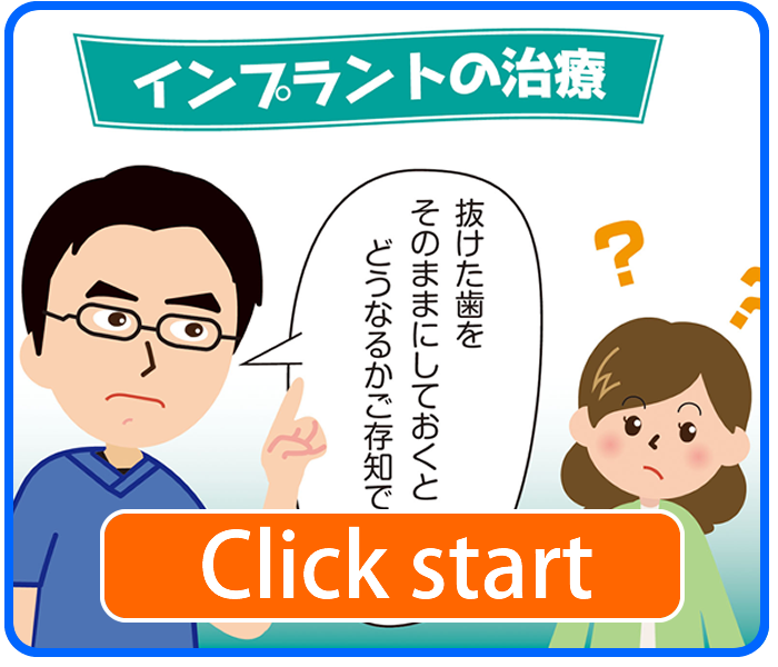 マンガで解説「インプラントの治療」